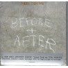 Neil Young - Before and After - Digipack - CD - Neu / OVP